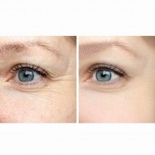 Rola Masaj Facial SIKS®, cu Doua Capete Tip Piatra Quartz, Negru