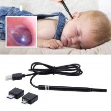Camera Endoscopica SIKS Pentru Inspecite Ureche, Nas, Piele, 6 LED, Incarcare USB, Cu Dipslay Inclus de 4,3 Inch Si Accesorii... Camera Endoscopica SIKS Pentru Inspecite Ureche, Nas, Piele, 6 LED, Incarcare USB, Cu Dipslay Inclus de 4,3 Inch Si Accesorii...