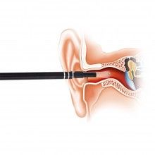 Camera Endoscopica EDAR, pentru Inspectie Ureche, Nas, Piele, Scalp, Cavitate Bucala, Alimentare USB, 6 LED-uri, Accesorii, A... Camera Endoscopica EDAR, pentru Inspectie Ureche, Nas, Piele, Scalp, Cavitate Bucala, Alimentare USB, 6 LED-uri, Accesorii, A...