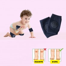 Set Protectie EDAR Pentru Copii Si Bebelusi, Bumbac, Silicon Antialunecare, Protejeaza Impotriva Zgarieturilor, 0-36 Luni, Bl...