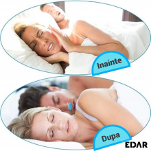 Aparat Nazal EDAR 2 în 1, Anti-sforait Si Filtrare Aer, Silicon Medical, Reutilizabil, Marime universala, Albastru