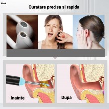 Aparat EDAR Pentru Curatare Urechi cu Camera Video Full HD, Otoscop Wireless Pentru Telefon, Set cu 6 Rezerve, Incarcare USB,...