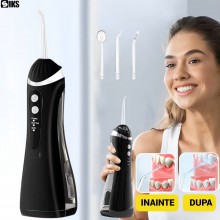 Irigator Bucal SIKS Dus Bucal Portabil Pentru Adulti Si Copii, Water Flosser IPX7, Irigator Oral Cu Presiune 1400 Pulsatii/mi...